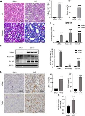 The Smad3-dependent microRNA let-7i-5p promoted renal fibrosis in mice with unilateral ureteral obstruction